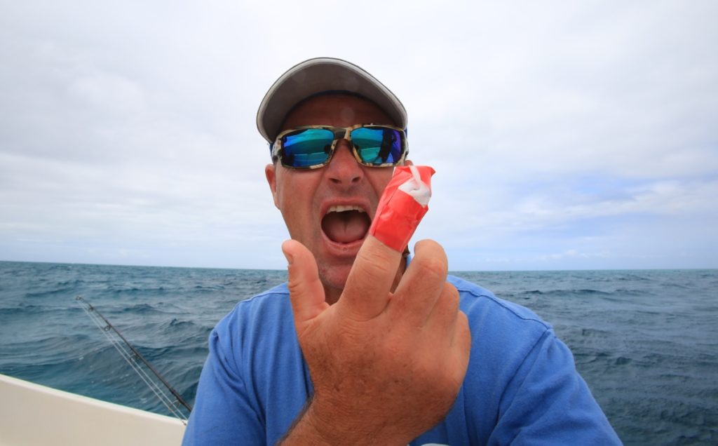 Angler with bandaged finger after casting braid