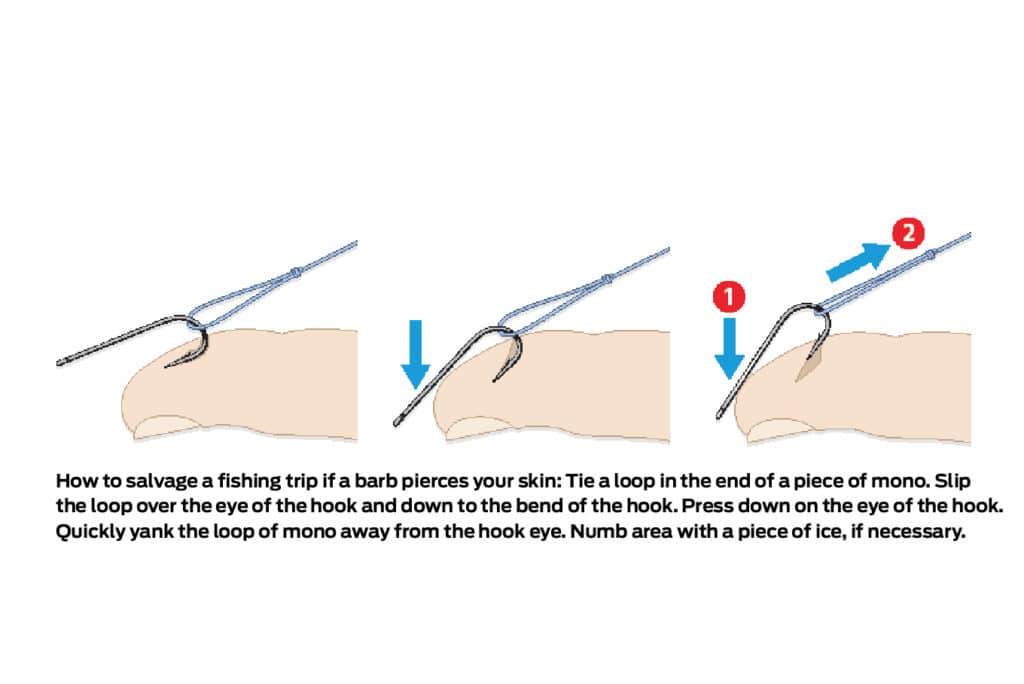 safety-tips-unhook-finger.jpg