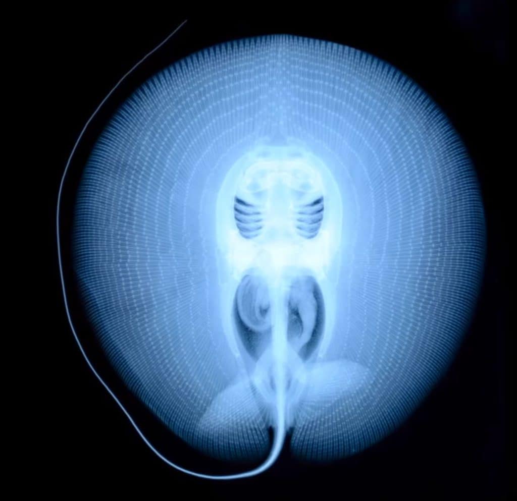 X-ray of a stingray